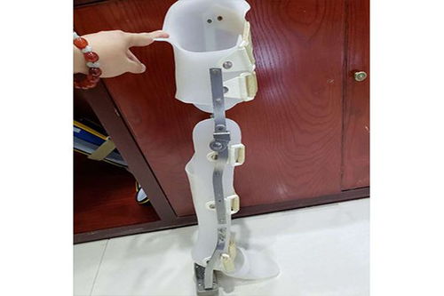 假肢與矯形器的使用周期與更換指南 科學(xué)維護(hù)，保障生活品質(zhì)